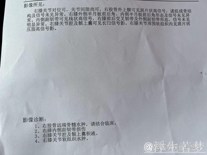 詹姆斯左膝内侧副韧带二级扭伤确诊 詹姆斯左膝内侧副韧带二级扭伤确诊